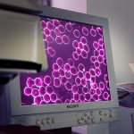 microscopia campo escuro