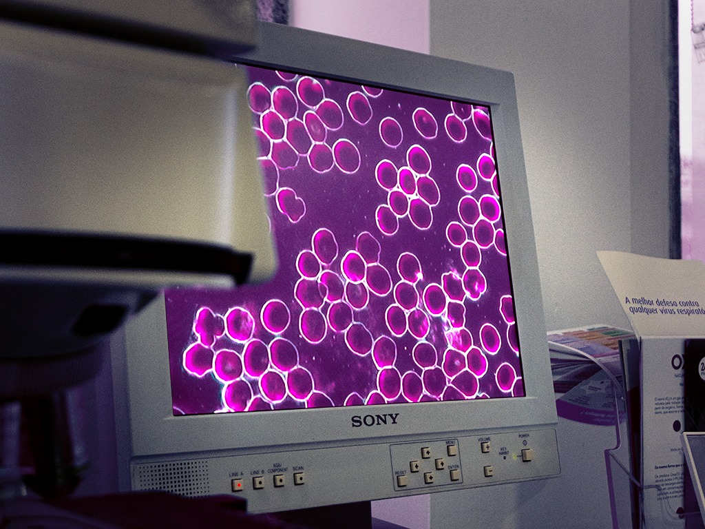 microscopia campo escuro